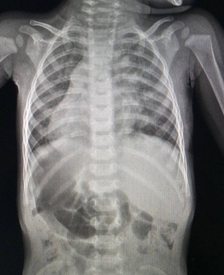 Лікарі у Львові врятували малюка